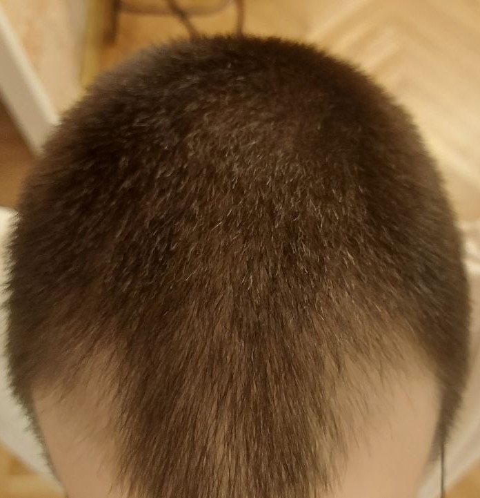 full_head_dark.jpg.f5891082265b1abc99b7ed11b64ea818.jpg
