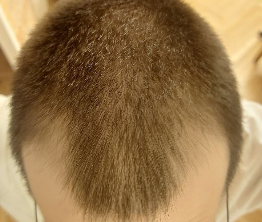 full_head_light.jpg.842c7714282d9b0aa73ce7c59d46c9c6.jpg