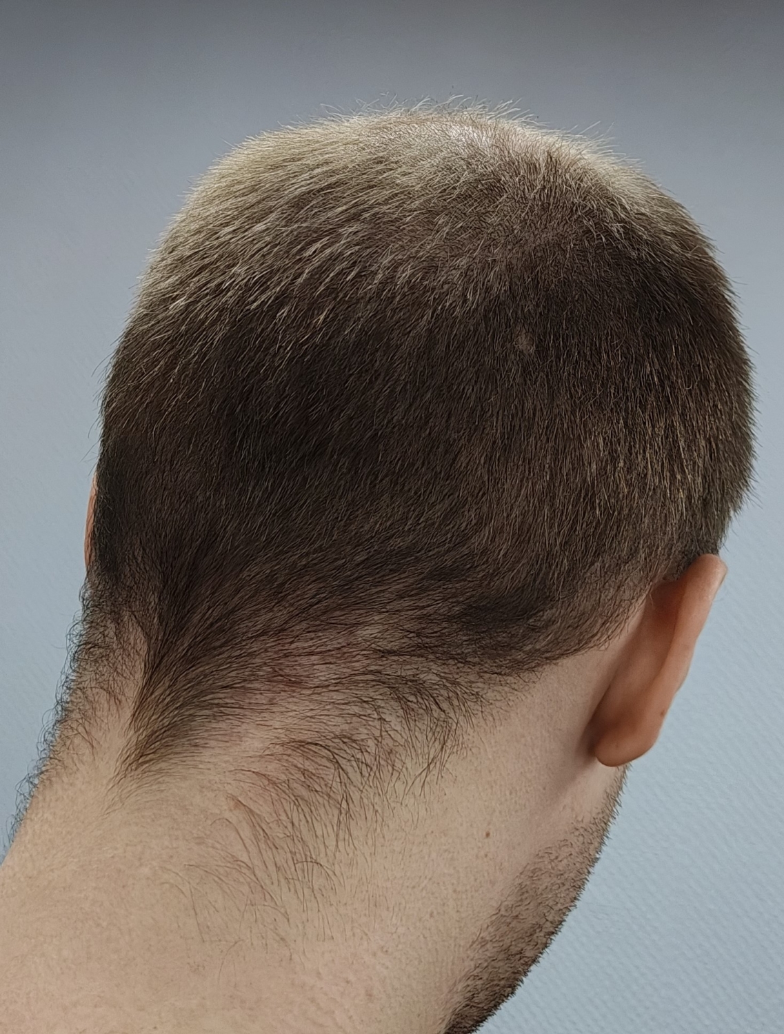 .thumb.jpg.10118f8b03b70961f3ff0798d64e3e2e.jpg