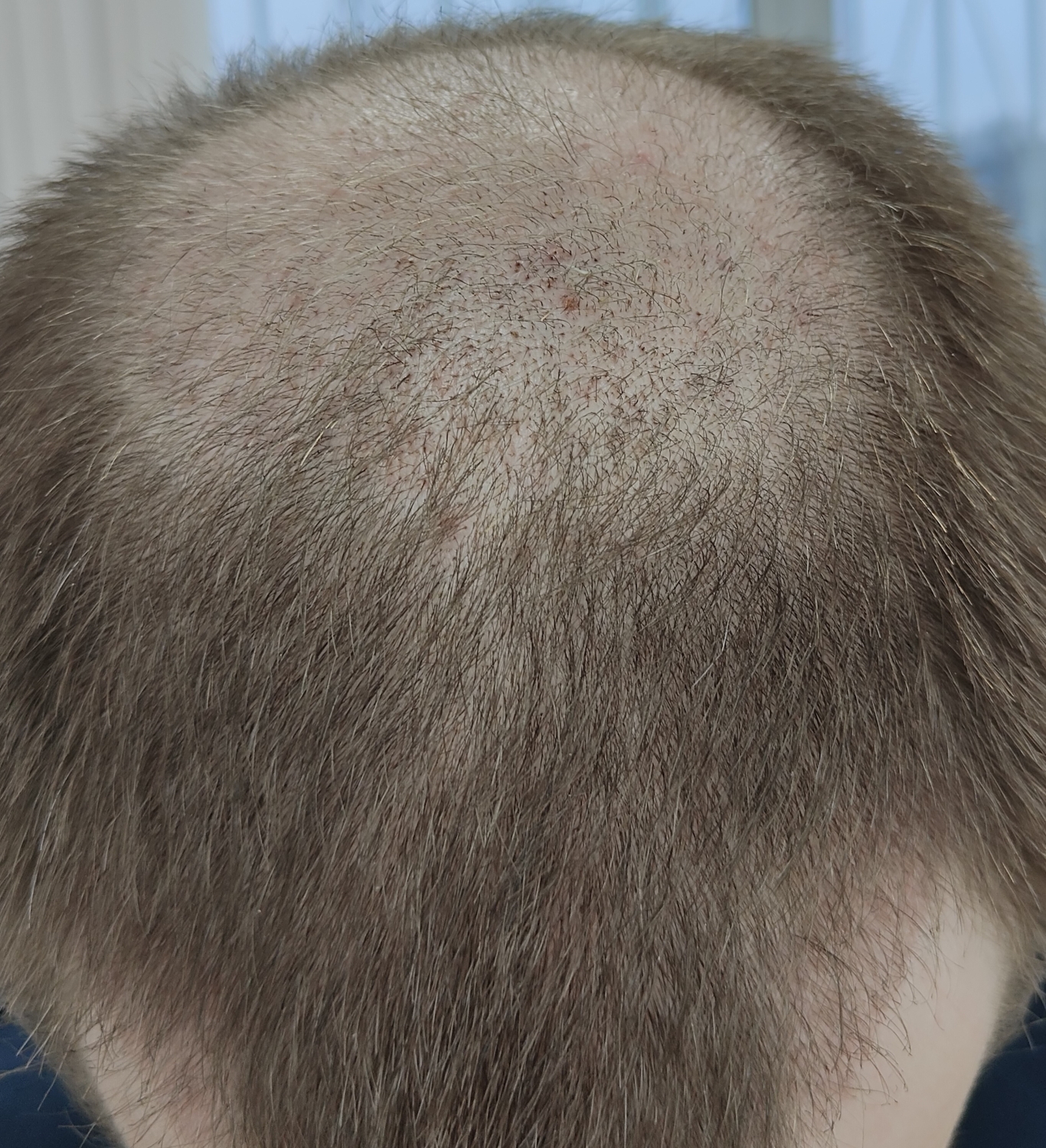 4.thumb.jpg.6e2570fb186eb88e83362e14dbed1791.jpg