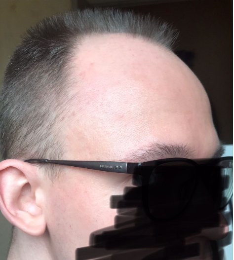 image.png.52195f0f34f1819c1f2de12d21b682a3.png