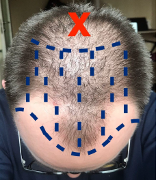 image.png.a49c7efb8d9ed51f770d925309bb5b07.png