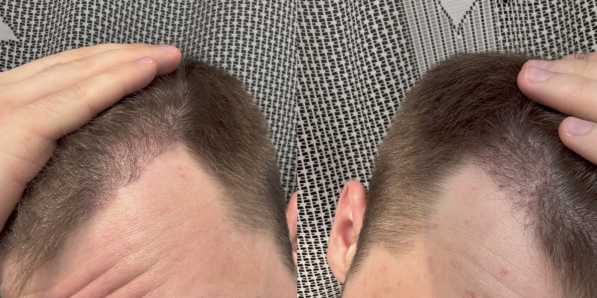1.thumb.jpg.8455d61ab88b5862f2c8979b5c3ccbbf.jpg