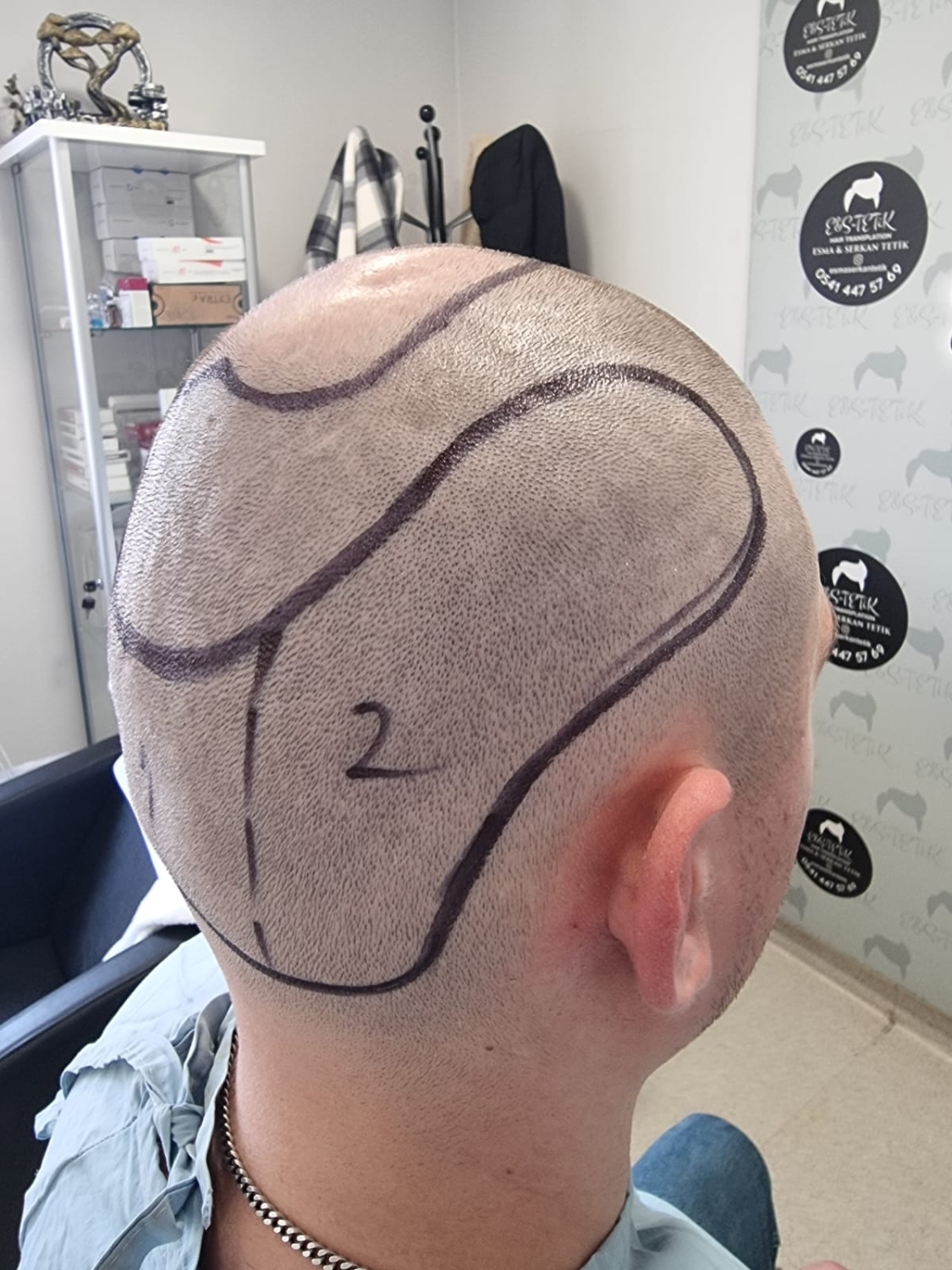 image.thumb.jpeg.23d1f7c4575e449d6a1ea170e5b0f625.jpeg