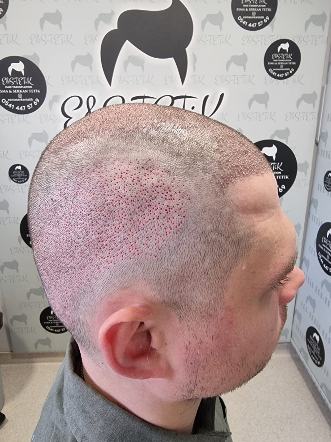 image.thumb.jpeg.2b1598a540991429e13d1155984b89af.jpeg