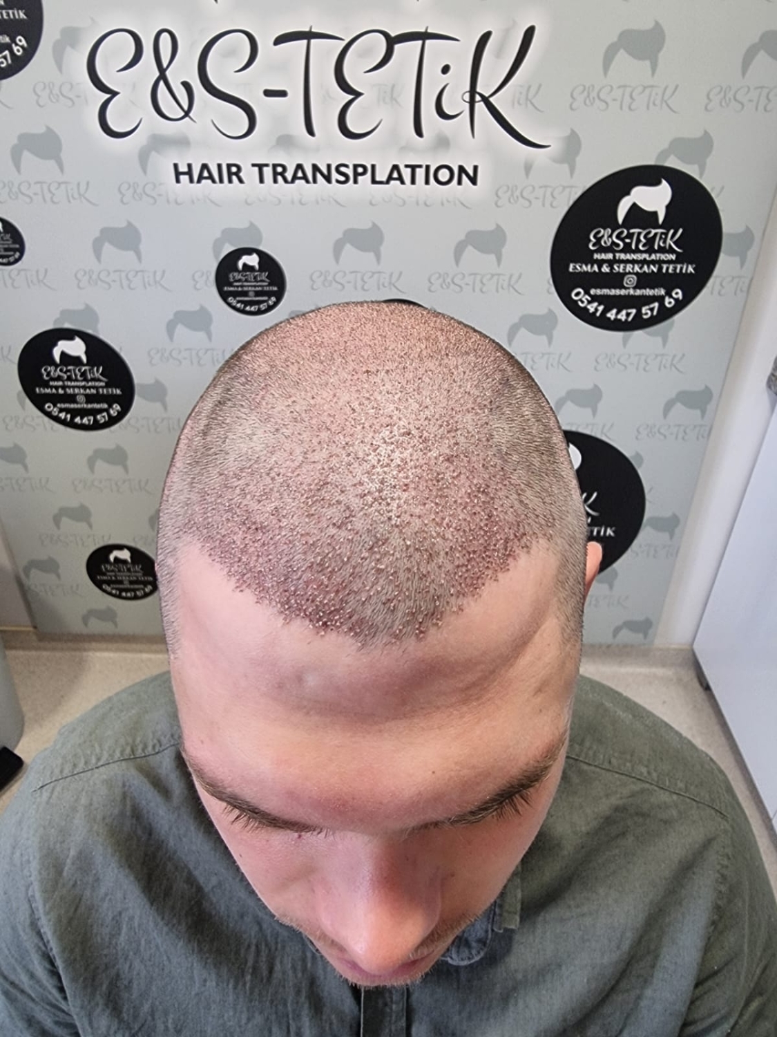 image.thumb.jpeg.7cdabf0d089e50a272b6fc1260435ba1.jpeg