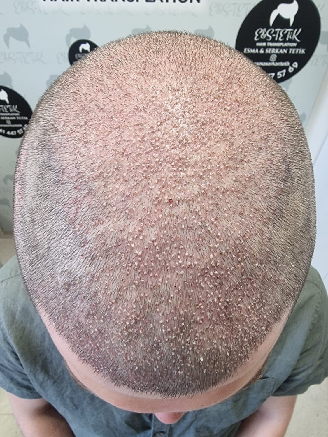 image.thumb.jpeg.8cfbce258c2b27f3fa7cfebe698ad184.jpeg