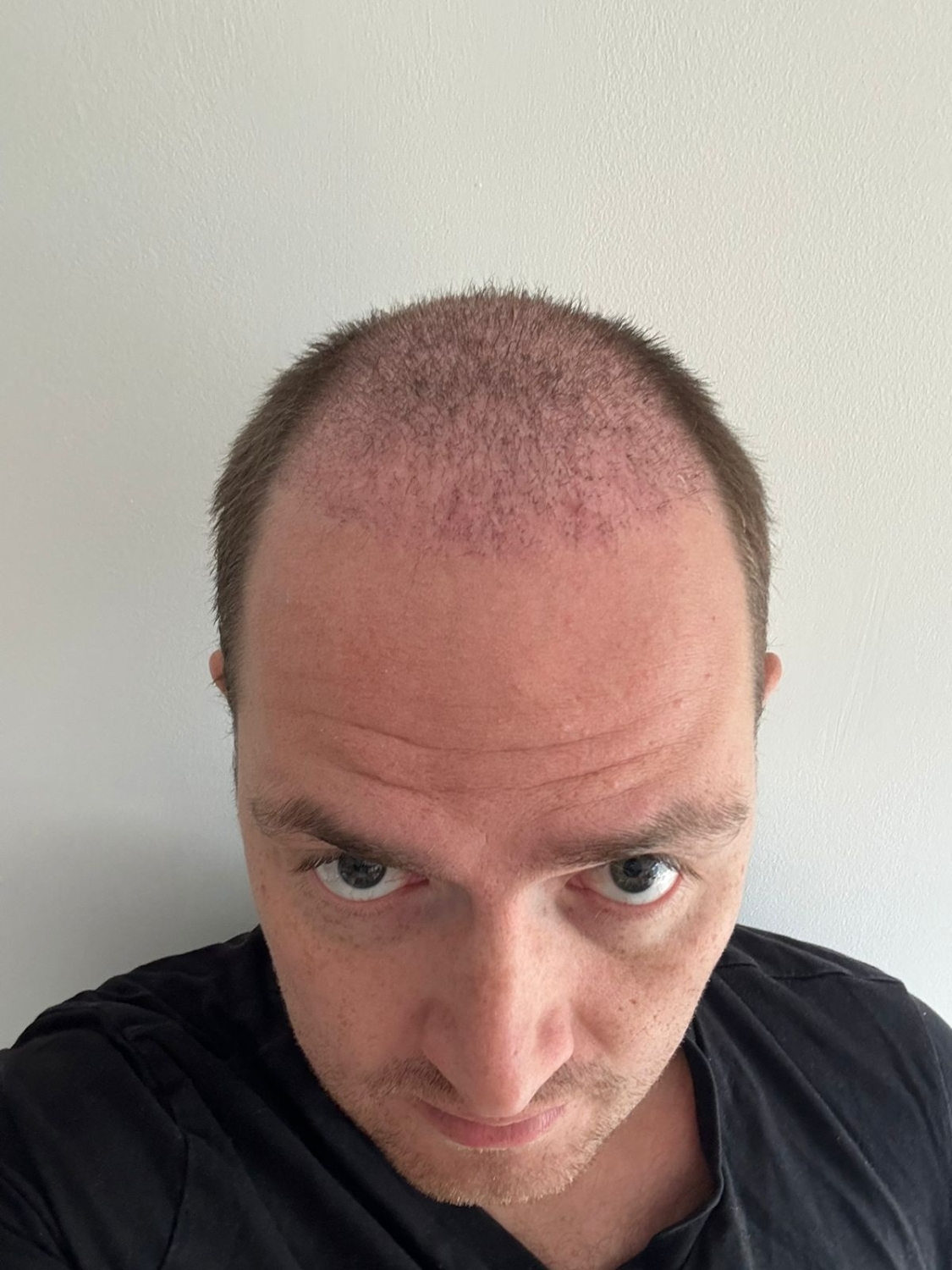 WhatsAppImage2025-09-06at11_23_55.thumb.jpeg.7f847e77cf28a06e26e650422a1268f6.jpeg